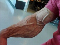 Pictures of weird veins and skin conditions - great inspiration for the texture of my demons